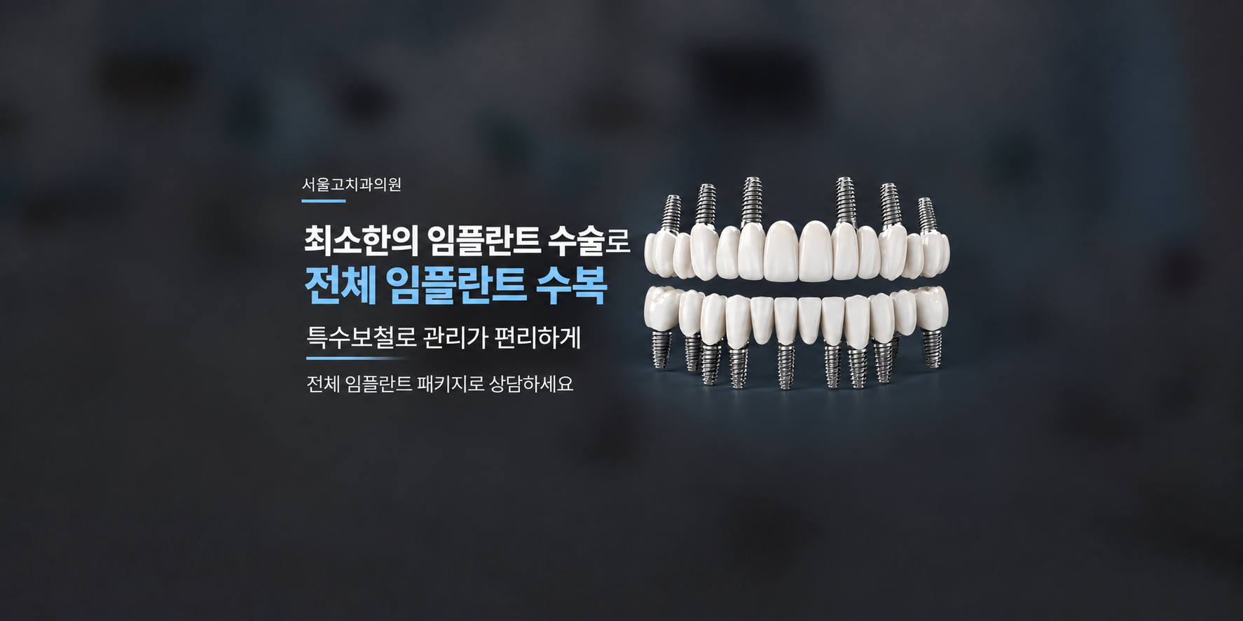 최소한의 임플란트 수술로 전체 임플란트 수복. 특수보철로 관리가 편리하게. 전체 임플란트 패키지로 상담하세요.